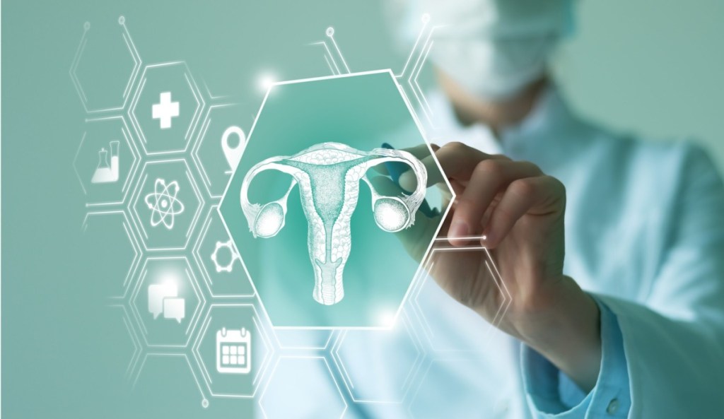 University of Iowa leads breakthrough in ovarian cancer research