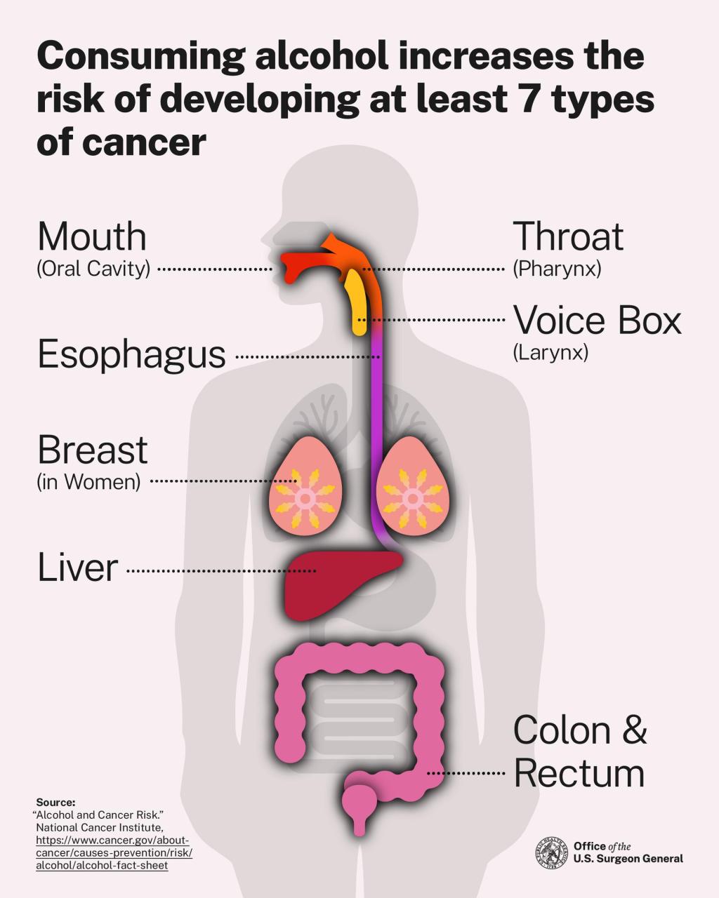 In Iowa, we love to drink. But no one told us alcohol causes cancer